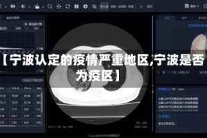 【宁波认定的疫情严重地区,宁波是否为疫区】
