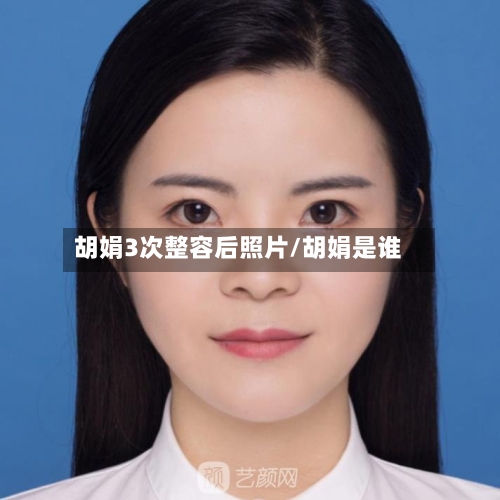 胡娟3次整容后照片/胡娟是谁-第2张图片