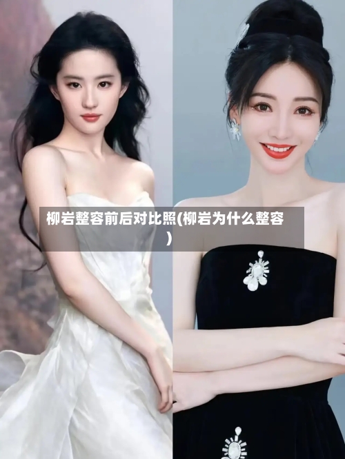 柳岩整容前后对比照(柳岩为什么整容)-第3张图片