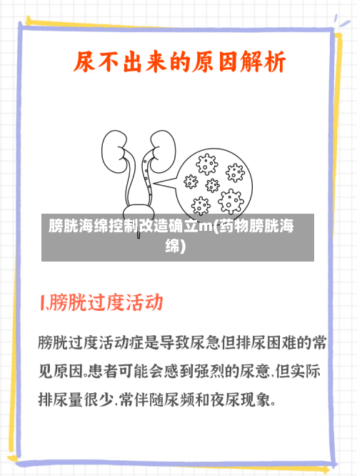 膀胱海绵控制改造确立m(药物膀胱海绵)-第2张图片